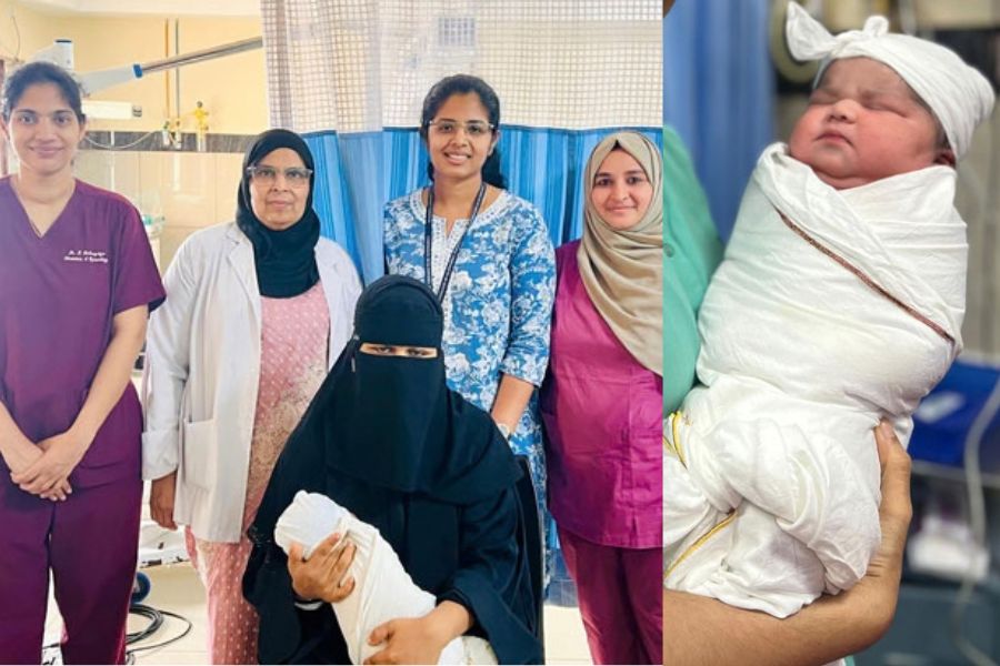 Mangalore yenepoya-medical-college-rare-delivery-5kg-baby-girl